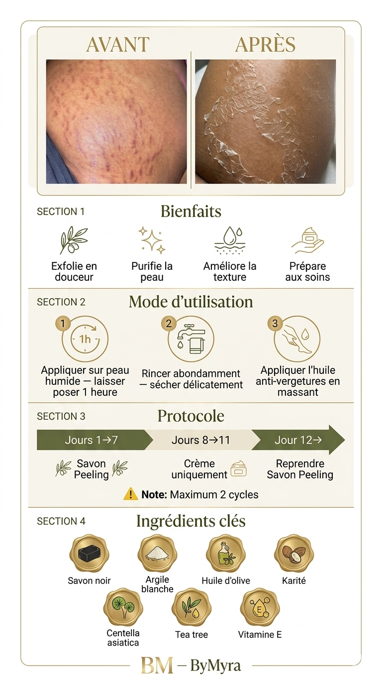 Savon Peeling Vergetures